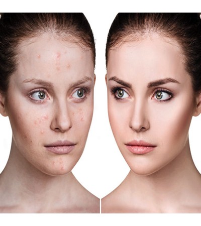 Salicylic Acid Cleanser Base