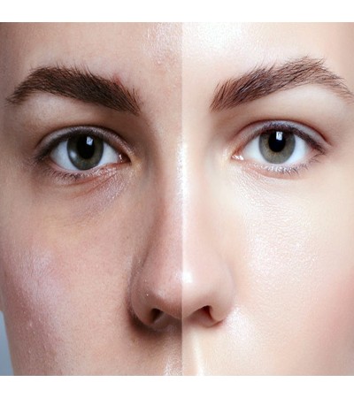 Skin White Cleanser Base